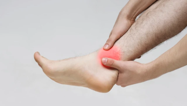 ankle sprain image
