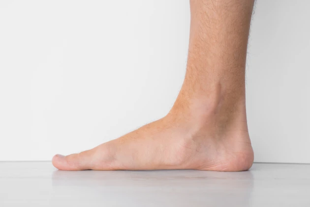 flat feet person image