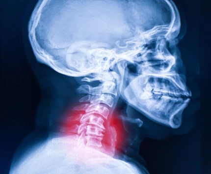 Cervical Pain cervical pain issues