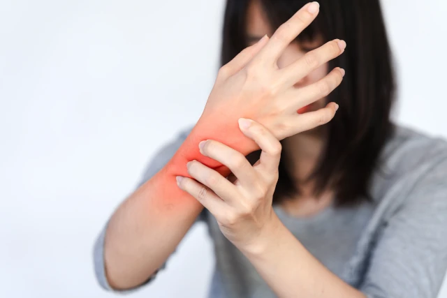 wrist fracture image