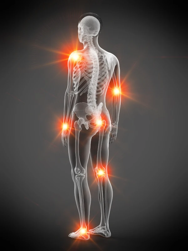 Arthritis Care